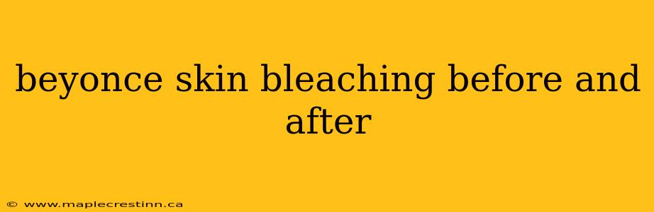 beyonce skin bleaching before and after